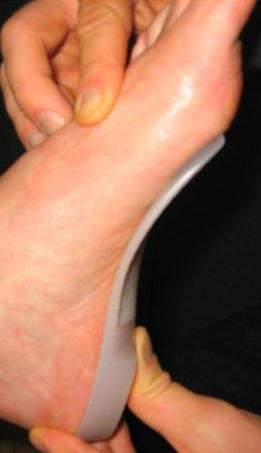 orthotics foot pain
