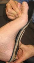 Big Toe Joint Pain Orthotics 