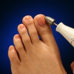 How to Cut Thick Toenails and Make Toenails Thin