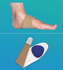 Flat Foot Treatment | 7 Step Treatment Plan for Flat Feet