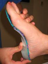 Sesamoiditis Treatment | Seattle Foot 